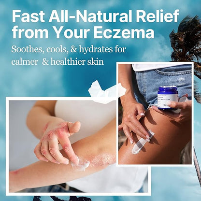 💥Daily Sales of 4000+🔥 2024 Hot Sale Seurico™ The Ocean Eczema Natural Soothing Cream