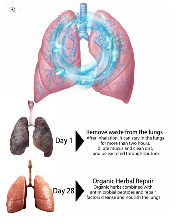 Seurico™ Organic Herbal Lung Cleanse Repair Nasal Spray-HM1